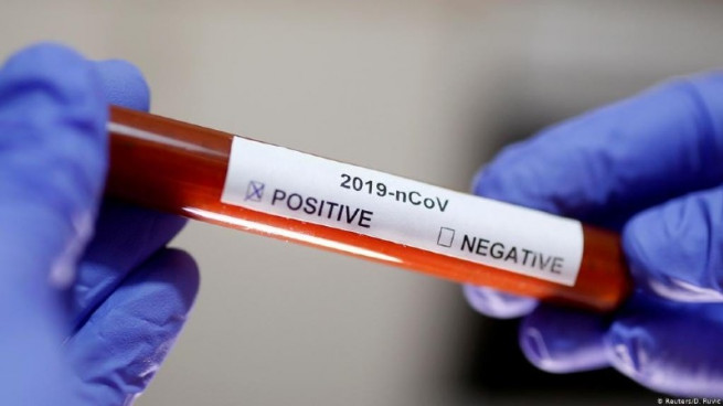 koronavirus
